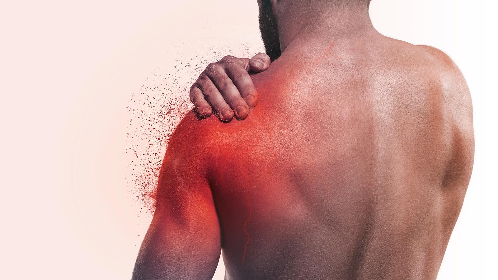 Punción Seca Qué es